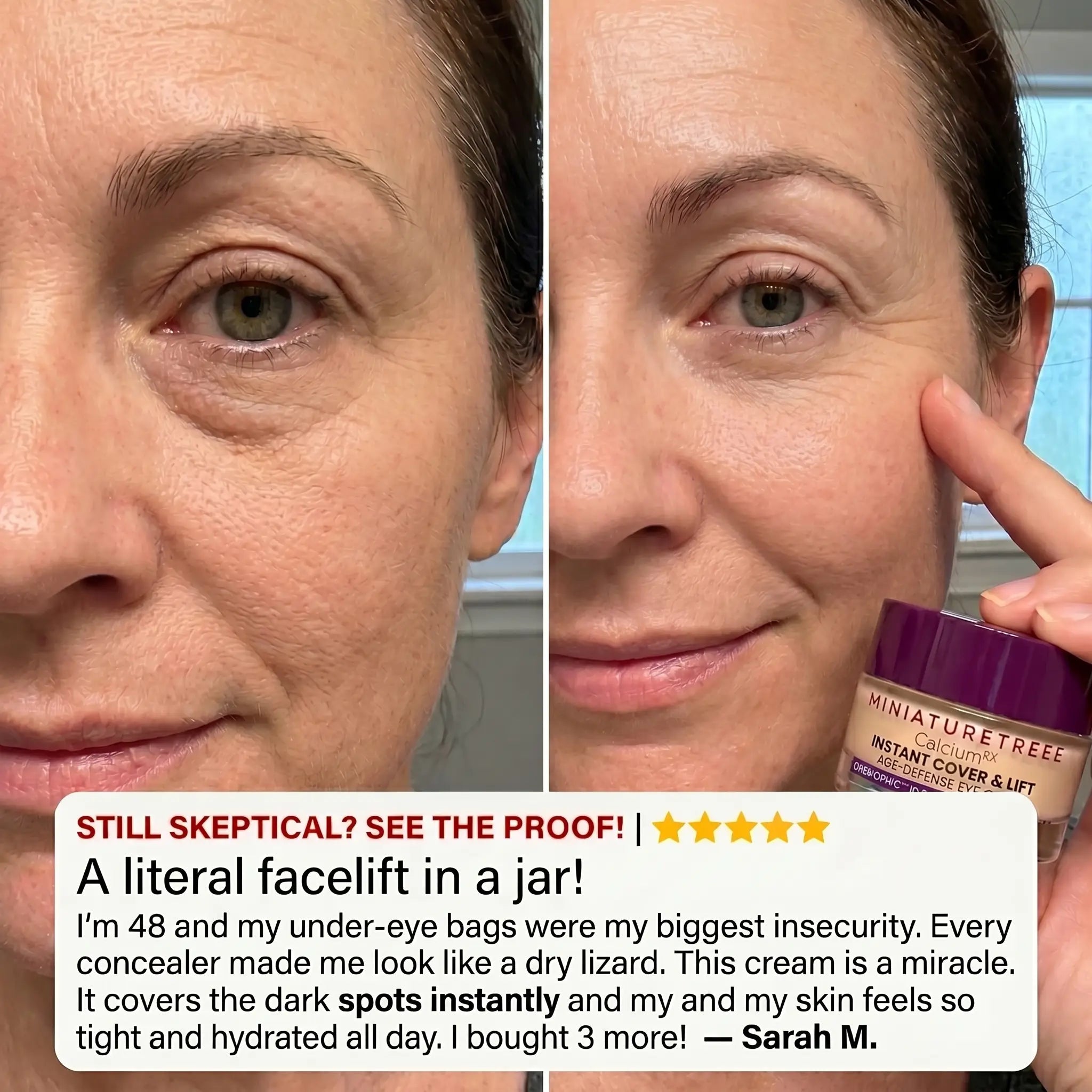 Miniaturetreee™ Calcium RX Age-Defense Eye Cream - Zero-Crease Flawless Camouflage & Long-Term Firming Radiance | Last Day Claim 90% OFF 🔥