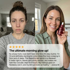 Miniaturetreee™ NAD+ Vitality Firming Serum - Visibly Smooths & Deeply Hydrates for a Radiant Glow | Last Day Claim 90% OFF🔥