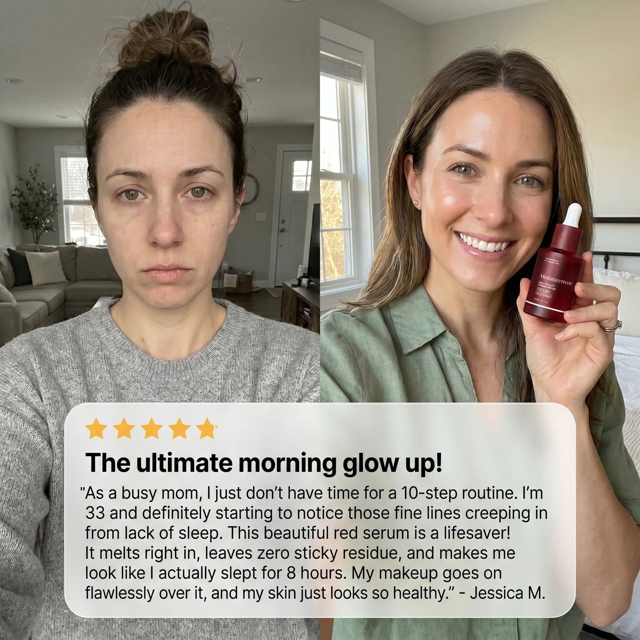 Miniaturetreee™ NAD+ Vitality Firming Serum - Visibly Smooths & Deeply Hydrates for a Radiant Glow | Last Day Claim 90% OFF🔥
