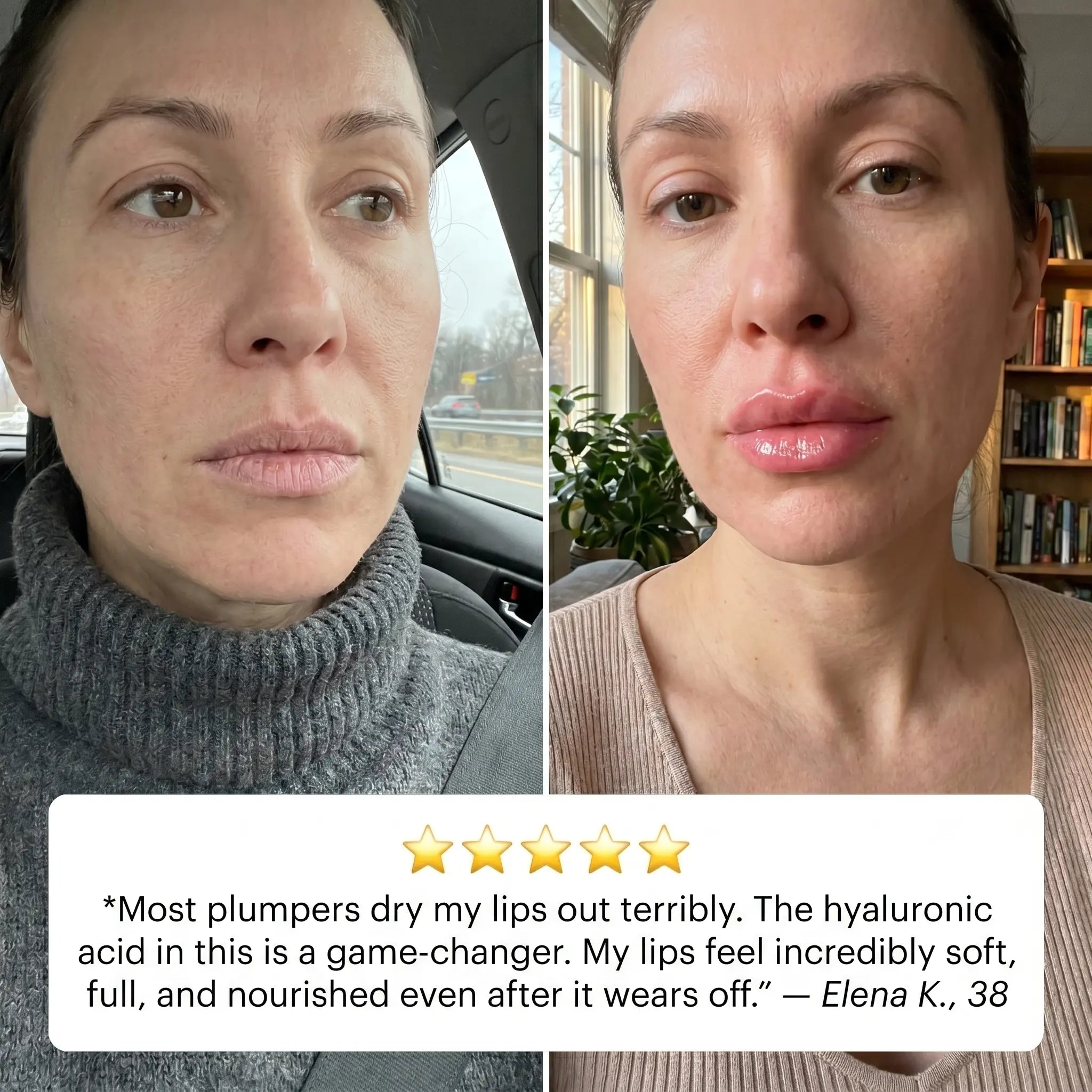 Miniaturetreee™ Bio-Spicule Plumping Lip Serum - Instant Natural Plump & 24/7 Glass-Like Hydration | Last Day Claim 90% OFF 🔥